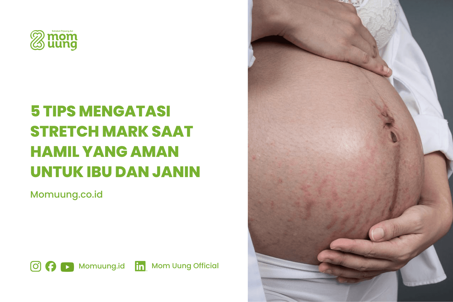 5 Tips Mengatasi Stretch Mark Saat Hamil yang Aman untuk Ibu dan Janin